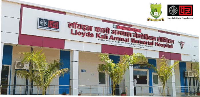 2. strc at lloyds metals